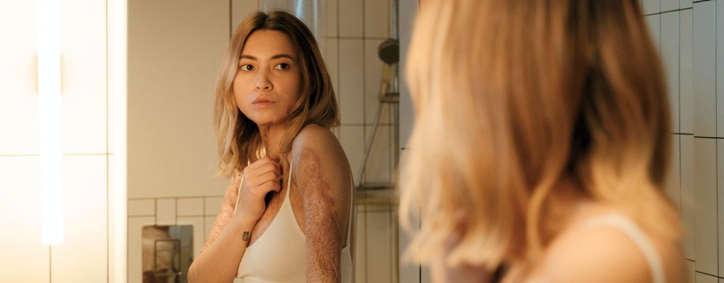 Renew Beauty Med Spa Partners with Nonprofit to Help Young Burn Survivors Find Self-Love