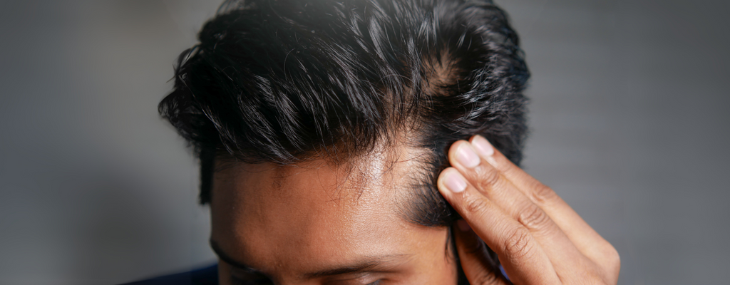 August is Hair Loss Awareness Month – Let’s Talk About Real Hair Loss Treatments That Work